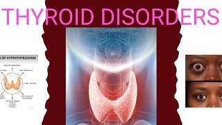 Thyroid disorders [upl. by Rebmetpes]