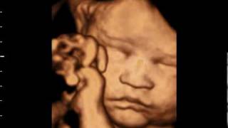 3D ultrasound at 31 weeks GoldenView Ultrasound [upl. by Mariko]