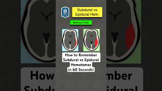 🔥 How to Remember Subdural vs Epidural Hematomas in 60 Seconds Nursing [upl. by Eaj240]