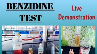 Benzidine test  Blood in urine  Hematuria  Biochemistry [upl. by Hecker]