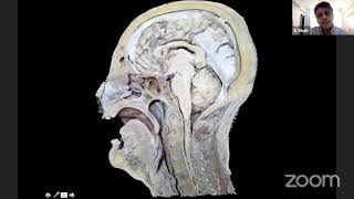 Microsurgical Anatomy of the Subarachnoid Cisterns [upl. by Kieran829]