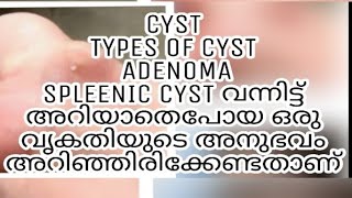 സിസ്ററ് കുറിച്ച് അറിയേണ്ടതെല്ലാം cyst Types of CystSplenic Cyst in Detail malayalam [upl. by Chace]