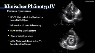 〖Echokardiografie〗 Pulmonale Hypertension  HFpEF Phänotyp🫀 [upl. by Nahsin]