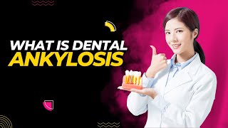 What is Dental Ankylosis 5 Symptoms You Should Know [upl. by Anifesoj]