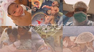 REAL BIRTH VLOG  REPEAT CSECTION 38 WEEKS  WELCOME BABY SERENITY  POSITIVE BIRTH EXPERIENCE [upl. by Brenn]