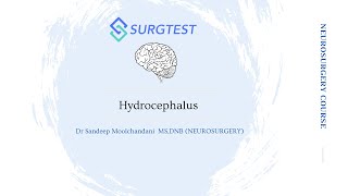 Hydrocephalus  Neurosurgery for INISS and FRCS Neurosurgery videos  Dr Sandeep Moolchandani [upl. by Minton749]