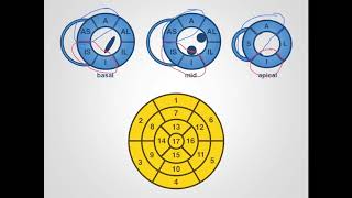 The fundamentals of left ventricular assessment in cardiac magnetic resonance imaging CMR [upl. by Gilbertson]