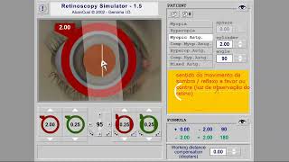 VÍDEO 2  Retinoscopia técnica por esferas [upl. by Craw]