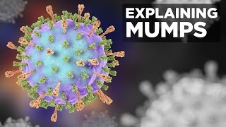 Explaining Mumps Michael Cooperstock MD [upl. by Elise]