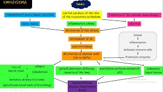 Emphysema Respiratory Disorders chapter 43 part 2 Guyton and Hall Physiology [upl. by Dion497]