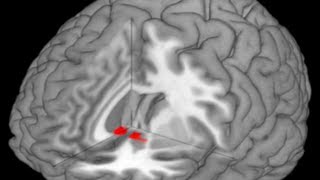 The Nucleus accumbens [upl. by Neely]