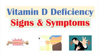 Vitamin D Deficiency Signs amp Symptoms ex Fatigue Diagnosis Treatment [upl. by Ellehcil]