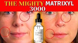 Matrixyl 3000  What is it for and What does matrixyl 3000 do for skin [upl. by Marjorie860]