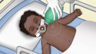 General Ventilator Setup by N McGowan  OPENPediatrics [upl. by Notlem]