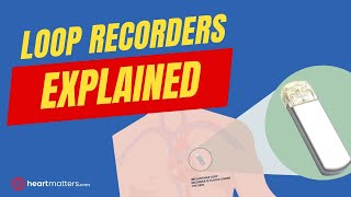 What are Loop Recorders  Implantable Heart Monitors [upl. by Acile]