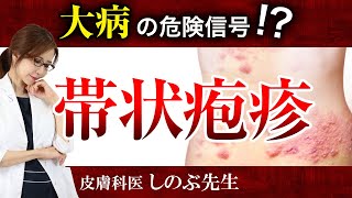 【危険信号！帯状疱疹】ただの皮膚炎ではなく、内蔵や神経にも影響を及ぼす病気です。詳しく説明します [upl. by Ahsial]