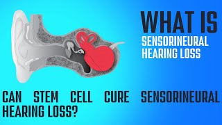 What is Sensorineural Hearing Loss How can it be treated [upl. by Cinelli378]