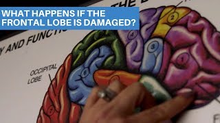 What Happens If The Frontal Lobe Is Damaged [upl. by Bautram]