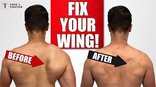 FIX Scapular Winging with Shoulder Blade Exercises [upl. by Nived]