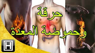 علاج حرقة المعدة والحموضة طبيعيا وبأفضل وأسهل الوصفات [upl. by Eldreda]