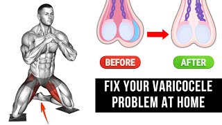 Top 6 Effective Exercises for Varicocele Treatment at Home [upl. by Templeton]