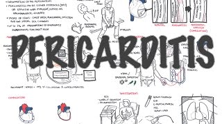 Pericardial Friction Rub Murmur Sound Pericardial Friction Rub Pericardial Friction Rub Sound [upl. by Kalvn]