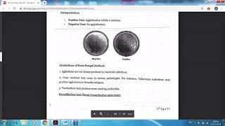 Brucella test [upl. by Atteuqram]