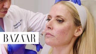 Umbilical Stem Cell Treatment  The Younger Games  Harpers BAZAAR [upl. by Mcdougall506]