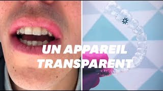 Les gouttières dentaires mises en causes par les orthodontistes [upl. by Ertemed]