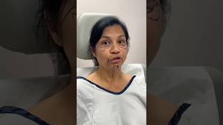 How Old is She 😳 Plastic Surgery Transformation facelift [upl. by Curcio633]