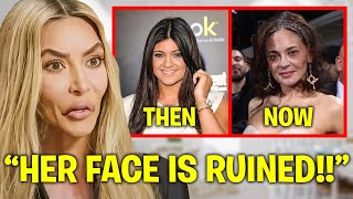 Kim Kardashian EXPOSES Kylie Jenner’s BOTCHED Plastic Surgery [upl. by Dlanor]