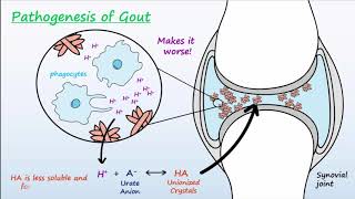 Gout  Mechanisms amp Treatment [upl. by Leirua]