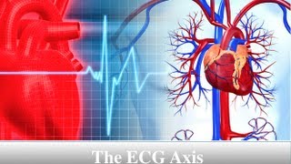 ECG Axis Tutorial Part 5  Rwave Progression [upl. by Rogergcam]