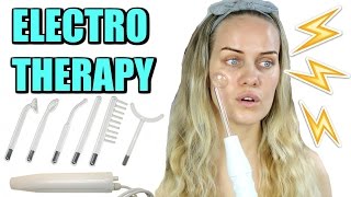 High Frequency Electrotherapy to treat ACNE [upl. by Eilema]