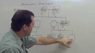 Autosomal Dominant Pedigree [upl. by Henderson738]