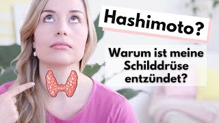 Hashimoto für Anfänger die 5 wichtigsten Basics zur Autoimmunerkrankung [upl. by Aldos158]