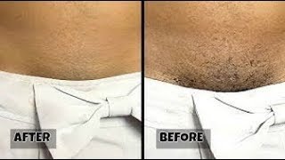 SE RASER LES POILS SANS RASOIR NI CRÈME ÉPILATOIRE EN 5 MINUTES REMOVE UNWANTED HAIR IN 5 MIN [upl. by Cahan]