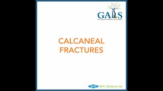 Calcaneal Fractures  Case Discussion  GAITS Academy [upl. by Mclaughlin]