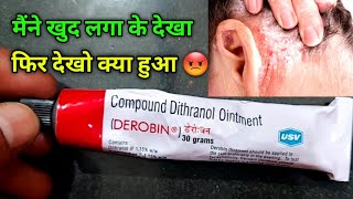 Derobin Cream Uses in Hindi  derobin Cream kis kaam mein ata hai  dad khaj khujli psoriasis [upl. by Naujak]