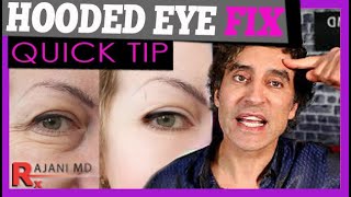 THE BROW LIFT EXPLAINED  Botox Brow Lift [upl. by Ytisahcal]