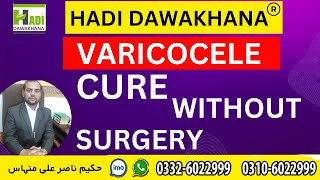 Varicocele Causes Symptoms Treatment in urdu  Hindi What is Varicocele  Varicocele ka desi ilaj [upl. by Eenert]