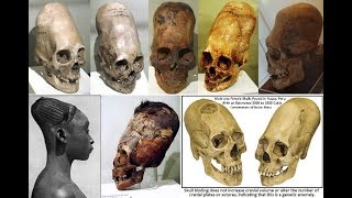 Analysis of the Elongated Paracas Skulls Nephilim [upl. by Assi]