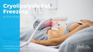 Cryolipolysis Fat Freezing [upl. by Hagen]