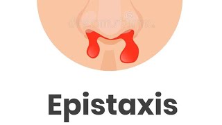 Epistaxis 2  SitesTypes amp Management of Epistaxis [upl. by Adlesirhc]