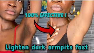 PRODUCTS THAT REMOVE DARK SPOTS AND DISCOLOURATION QUICKLY‼️ [upl. by Suirauqram392]