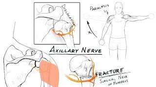 The Brachial Plexus II Animated Review HD [upl. by Soelch175]