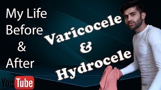 Varicocele treatment  My Story about Varicocele amp Hydrocele after amp before  without surgery amp med [upl. by Wildee]