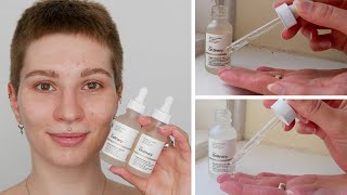 How to use The Ordinary Alpha Arbutin and Niacinamide together [upl. by Bilbe111]