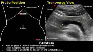 Pancreas Ultrasound Probe Positioning  Transducer Placement amp Scanning  Abdominal USG  Sonography [upl. by Nonahs951]