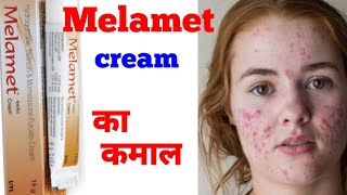 Melamet cream side effects amp Benefits [upl. by Viscardi]